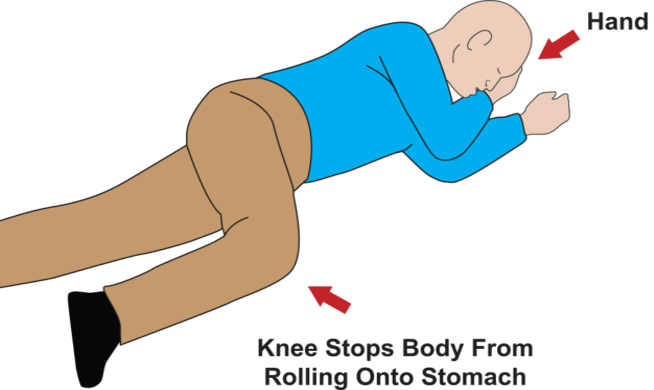 Person on their side, with right hand under cheek and right knee inward and bent in the recovery position.